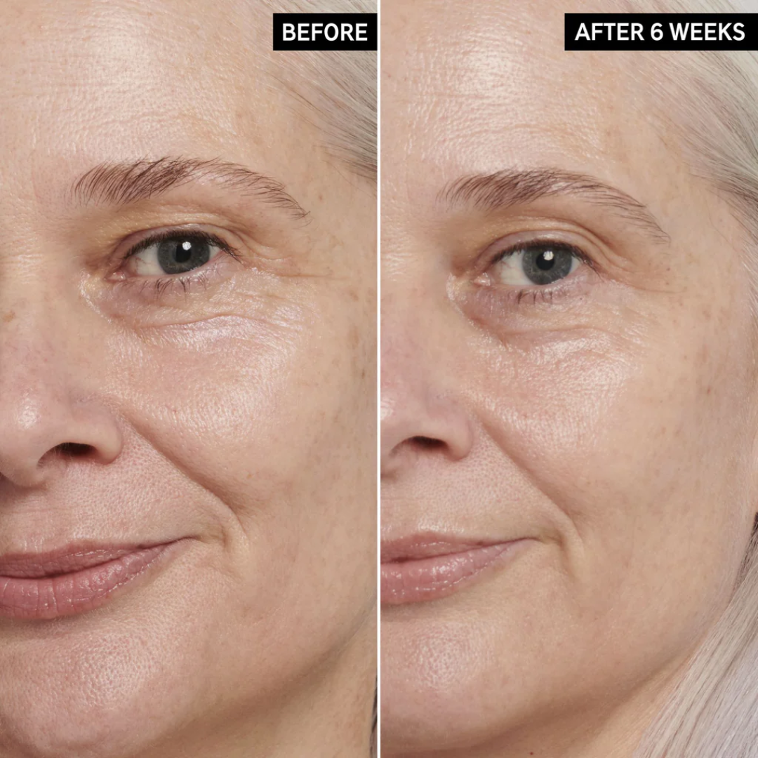 Anua retinol cream - Reduce Wrinkle, fine lines & Hyperpigmentation - Guaranteed Results