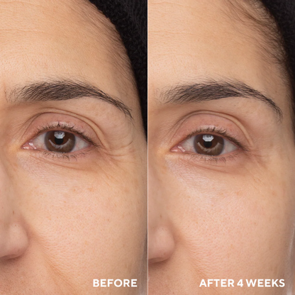 Anua retinol cream - Reduce Wrinkle, fine lines & Hyperpigmentation - Guaranteed Results
