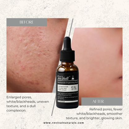 Teashell Niacinamide Brightening Serum |BUY ONE GET ONE FREE/ Fades Dark Spots, Evens Skin Tone & Boosts Glow
