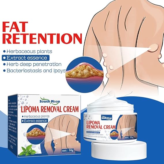 South Moon Lipoma Removal Cream(Buy 1 Get 1 Free)