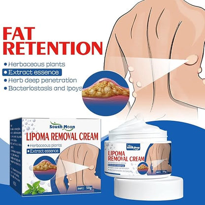 South Moon Lipoma Removal Cream(Buy 1 Get 1 Free)