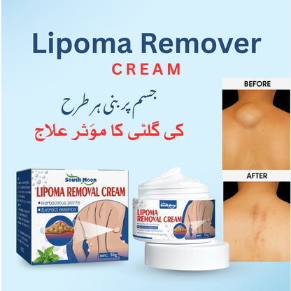 South Moon Lipoma Removal Cream(Buy 1 Get 1 Free)