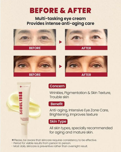 SEOUL 1988 Eye Cream – Retinal Liposome 4% + Fermented Bean