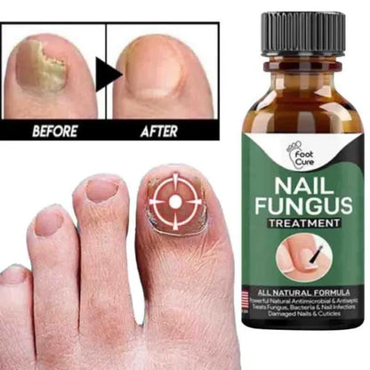 Fast Nail Fungal Treatment Serum