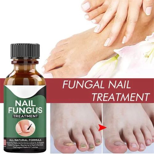 Fast Nail Fungal Treatment Serum